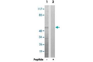 Western blot analysis of extracts from HepG2 cells, using UBXN11 polyclonal antibody .