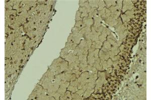ABIN6276815 at 1/100 staining Mouse brain tissue by IHC-P. (POLB antibody  (C-Term))