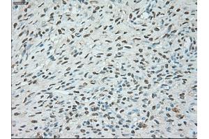 Immunohistochemical staining of paraffin-embedded colon tissue using anti-USP13mouse monoclonal antibody. (USP13 antibody)