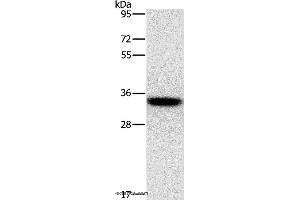 Western blot analysis of PC3 cell, using HOXB13 Polyclonal Antibody at dilution of 1:800