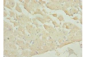 Immunohistochemistry of paraffin-embedded human heart tissue using ABIN7163185 at dilution of 1:100 (PIP5K1A antibody  (AA 293-562))