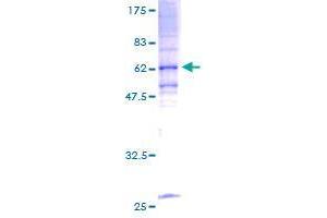 Image no. 1 for Translocation Associated Membrane Protein 1 (TRAM1) (AA 1-374) protein (GST tag) (ABIN1323528) (TRAM1 Protein (AA 1-374) (GST tag))