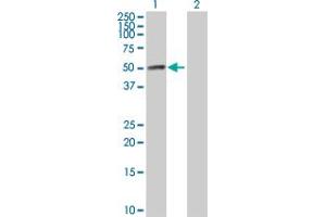 Western Blot analysis of HAVCR1 expression in transfected 293T cell line by HAVCR1 MaxPab polyclonal antibody. (HAVCR1 antibody  (AA 1-364))