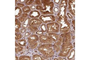Immunohistochemical staining (Formalin-fixed paraffin-embedded sections) of human kidney with ART1 polyclonal antibody  shows strong cytoplasmic and membranous positivity in cells in tubules. (ART1 antibody  (AA 37-122))