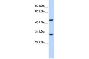 Western Blotting (WB) image for anti-Pygopus Homolog 2 (PYGO2) antibody (ABIN2459475) (PYGO2 antibody)