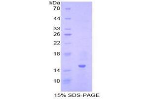 SDS-PAGE analysis of Pig Inhibin beta A Protein. (INHBA Protein)