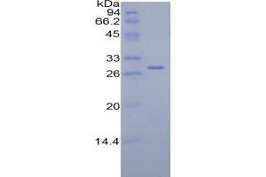 SDS-PAGE of Protein Standard from the Kit (Highly purified E. (Complement Factor H ELISA Kit)