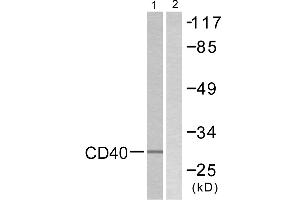 Immunohistochemistry analysis of paraffin-embedded human breast carcinoma tissue using CD40 antibody. (CD40 antibody  (C-Term))