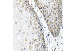 Immunohistochemistry of paraffin-embedded human esophagus using ANGPT1 antibody at dilution of 1:100 (40x lens). (Angiopoietin 1 antibody)