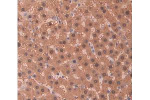 Used in DAB staining on fromalin fixed paraffin- embedded Kidney tissue (PIDD antibody  (AA 668-917))