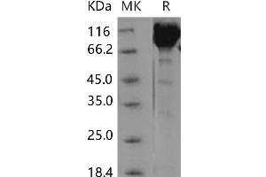 Western Blotting (WB) image for Contactin 1 (CNTN1) protein (His tag) (ABIN7195254) (Contactin 1 Protein (CNTN1) (His tag))