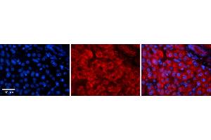 Rabbit Anti-GREB1 Antibody    Formalin Fixed Paraffin Embedded Tissue: Human Adult liver  Observed Staining: Cytoplasmic,Membrane Primary Antibody Concentration: 1:100 Secondary Antibody: Donkey anti-Rabbit-Cy2/3 Secondary Antibody Concentration: 1:200 Magnification: 20X Exposure Time: 0.