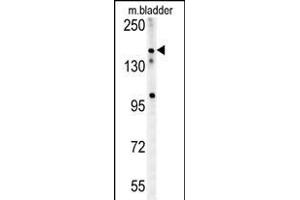 CASZ1 Antibody (C-term) (ABIN654196 and ABIN2844046) western blot analysis in mouse bladder tissue lysates (15 μg/lane).