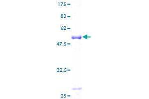 RNF114 Protein (AA 1-228) (GST tag)