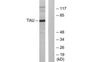 Western blot analysis of extracts from MDA-MB-435 cells, using Tau (Ab-231) Antibody. (tau antibody  (AA 521-570))