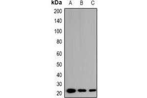 Western blot analysis of EID1 expression in PC3 (A), HeLa (B), HCT116 (C) whole cell lysates. (EID1 antibody)
