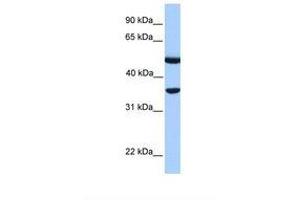 Image no. 1 for anti-DnaJ (Hsp40) Homolog, Subfamily B, Member 6 (DNAJB6) (AA 36-85) antibody (ABIN6738835) (DNAJB6 antibody  (AA 36-85))