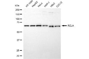 Western blotting analysis using RELA antibody (ABIN7799647). (NF-kB p65 antibody)