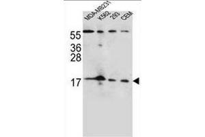 FGF22 Antibody (N-term) western blot analysis in MDA-MB231,K562,293,CEM cell line lysates (35µg/lane). (FGF22 antibody  (N-Term))