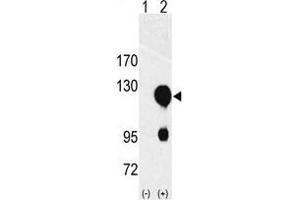 Image no. 1 for anti-Receptor Tyrosine Kinase-Like Orphan Receptor 2 (ROR2) (N-Term) antibody (ABIN359930) (ROR2 antibody  (N-Term))