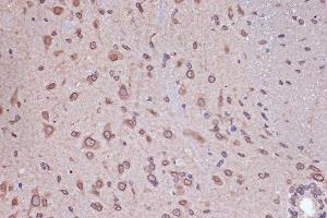 Immunohistochemistry of paraffin-embedded mouse spinal cord using RanG Rabbit mAb (ABIN7269846) at dilution of 1:100 (40x lens). (RANGAP1 antibody)
