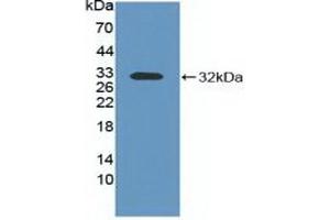 Western blot analysis of recombinant Mouse ITGaV. (CD51 antibody  (AA 71-322))