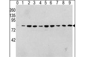 Western blot analysis of Phospho-RAF1-p Antibody in human T activated Hela cell line lysates. (RAF1 antibody  (pSer338))