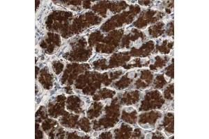 Immunohistochemical staining (Formalin-fixed paraffin-embedded sections) of human stomach with TNFRSF14 polyclonal antibody  shows strong cytoplasmic positivity in glandular cells at 1:20 - 1:50 dilution. (HVEM antibody)