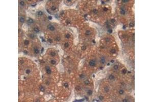 Used in DAB staining on fromalin fixed paraffin- embedded Kidney tissue (PSMD6 antibody  (AA 1-389))