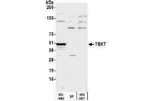 anti-T-Box 19 (TBX19) (AA 350-400) antibody