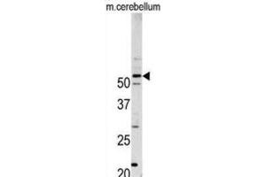 Western Blotting (WB) image for anti-Cyclin-Dependent Kinase 14 (CDK14) antibody (ABIN3003282) (CDK14 antibody)