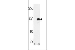 Western blot analysis of RENT1 using rabbit polyclonal RENT1 Antibody using 293 cell lysates (2 ug/lane) either nontransfected (Lane 1) or transiently transfected with the RENT1 gene (Lane 2). (RENT1/UPF1 antibody  (N-Term))