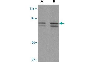 Western blot analysis of ATF6 in MCF-7 cell lysate with ATF6 polyclonal antibody  at (A) 0. (ATF6 antibody  (C-Term))