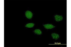 Immunofluorescence of purified MaxPab antibody to TWIST1 on HeLa cell. (TWIST1 antibody  (AA 1-202))