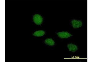 Immunofluorescence of purified MaxPab antibody to TWIST1 on HeLa cell.