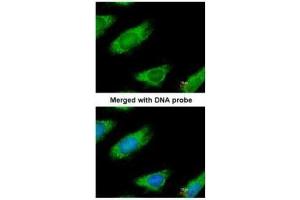 ICC/IF Image Immunofluorescence analysis of paraformaldehyde-fixed HeLa, using ME1, antibody at 1:200 dilution. (ME1 antibody)