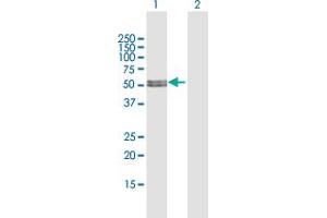 Western Blot analysis of MLYCD expression in transfected 293T cell line by MLYCD MaxPab polyclonal antibody.