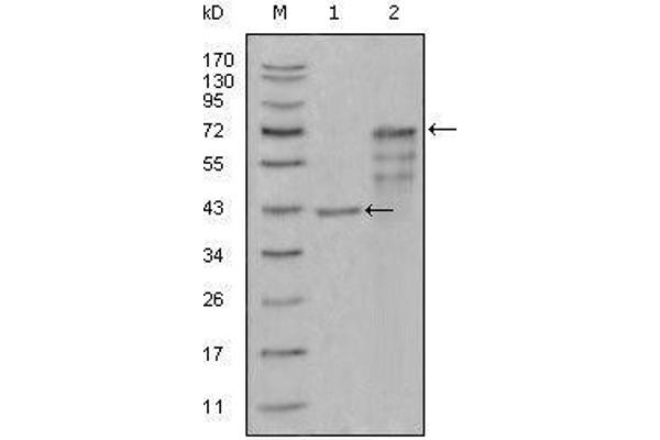 Chitotriosidase 1 Antikörper  (AA 22-137)