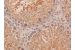 Used in DAB staining on fromalin fixed paraffin-embedded Kidney tissue (PARK7/DJ1 antibody  (AA 1-189))