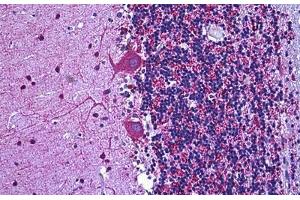 Human Brain Cerebellum: Formalin-Fixed, Paraffin-Embedded (FFPE) (Glutamic Acid Decarboxylase antibody  (AA 545-594))