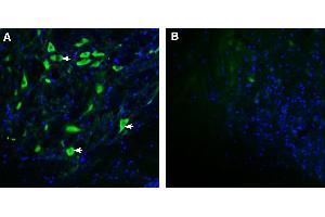 Expression of GPRC5B in mouse deep cerebellar nuclei.