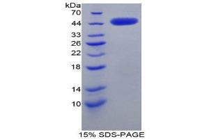 SDS-PAGE (SDS) image for Corticotropin Releasing Hormone (CRH) (AA 39-187) protein (His tag,GST tag) (ABIN2122709)