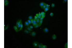 Immunofluorescence staining of HepG2 cells with ABIN7144643 at 1:133, counter-stained with DAPI.