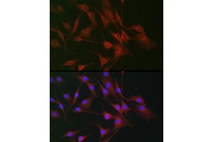 Immunofluorescence analysis of NIH/3T3 cells using IL6ST antibody (ABIN7268003) at dilution of 1:100. (CD130/gp130 antibody  (AA 678-857))