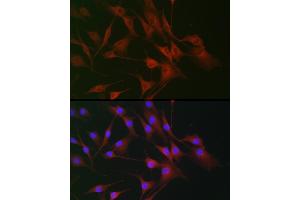 Immunofluorescence analysis of NIH/3T3 cells using IL6ST antibody (ABIN7268003) at dilution of 1:100. (CD130/gp130 antibody  (AA 678-857))