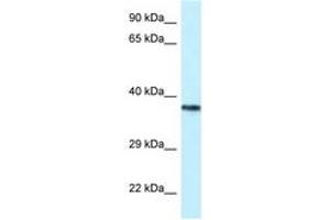 Image no. 1 for anti-Proline-serine-threonine Phosphatase Interacting Protein 2 (PSTPIP2) (AA 122-171) antibody (ABIN6747506) (PSTPIP2 antibody  (AA 122-171))