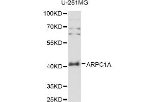 Western blot analysis of extracts of U-251MG cells, using ARPC1A antibody (ABIN6291261) at 1:3000 dilution. (ARPC1A antibody)