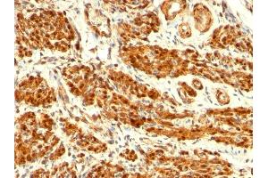 Formalin-fixed, paraffin-embedded human Uterus stained with Calponin-1 Mouse Monoclonal Antibody (CNN1/832).