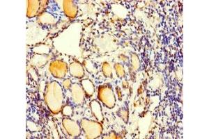Immunohistochemistry of paraffin-embedded human thyroid tissue using ABIN7175061 at dilution of 1:100 (C5orf51 antibody  (AA 8-152))