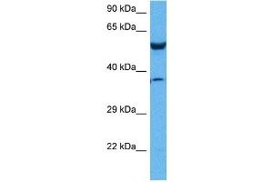 Western Blotting (WB) image for anti-Prolyl 4-Hydroxylase, beta Polypeptide (P4HB) (N-Term) antibody (ABIN2783245)